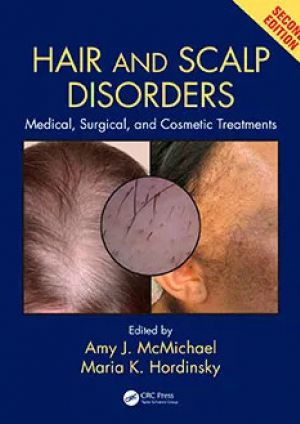 HAIR AND SCALP DISORDERS